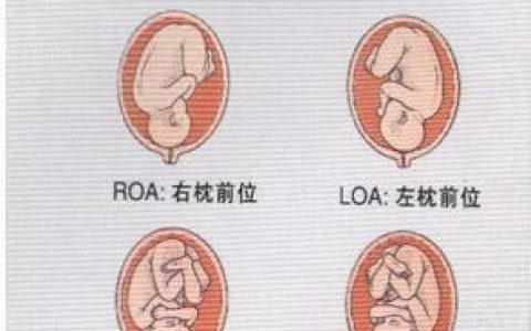 roa是什么指标？如何计算和分析？